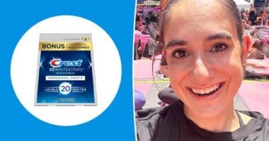 I tried the bestselling teeth whitening kit