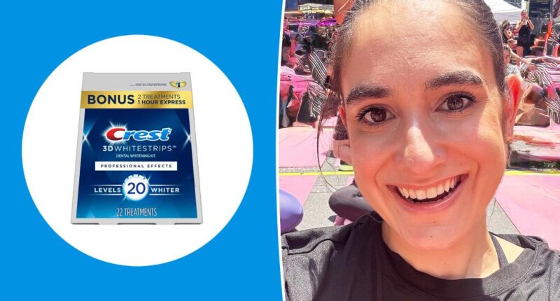 I tried the bestselling teeth whitening kit