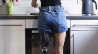 Emily Fogly, 27, who had pediatric bone cancer , had part of her knee removed after being diagnosed when she was just 15 years old (stock image)