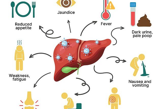 Hepatitis often has no noticeable symptoms but tell-tale signs can be a change in bowel movements, nausea, joint pain, fever and fatigue