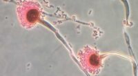 Aspergillus fungus is a toxic fungus that kills up to 50 percent of patients. But researchers have found some forms of it may help treat leukemia
