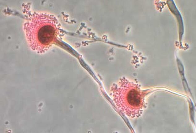 Aspergillus fungus is a toxic fungus that kills up to 50 percent of patients. But researchers have found some forms of it may help treat leukemia