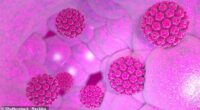 Anal cancer is on the rise, with specialist Dr. Evan Goldstein sharing a little-known warning sign that can increase the risk, which he dubs a 'silent disease'