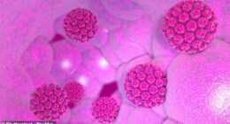 Anal cancer is on the rise, with specialist Dr. Evan Goldstein sharing a little-known warning sign that can increase the risk, which he dubs a 'silent disease'