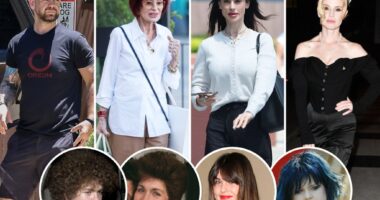See photos before and after weight loss