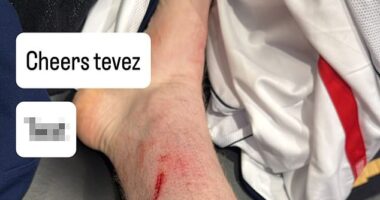 Angry Ginge took to social media to share a photo of a cut on his leg left by Carlos Tevez
