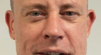 Wayne Bridge has revealed the results of his £7,000 hair transplant as he shared his delight with how the procedure had gone (pictured before)