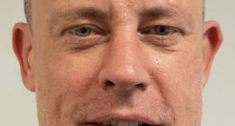 Wayne Bridge has revealed the results of his £7,000 hair transplant as he shared his delight with how the procedure had gone (pictured before)