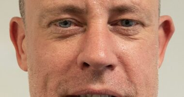 Wayne Bridge has revealed the results of his £7,000 hair transplant as he shared his delight with how the procedure had gone (pictured before)