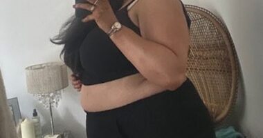 Hannah Mai, 37, found herself suddenly gaining weight rapidly because of a hormonal disorder called Cushing's disease
