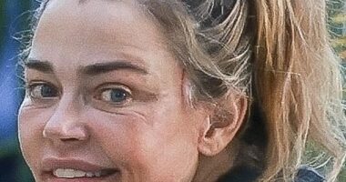 Denise Richards ignited rampant plastic surgery speculation as she stepped out in LA this week - just days after making domestic violence claims against her estranged husband in a court paper
