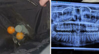 62 Times People Forgot Something And Ended Up In Funny Unfortunate Situations (New Pics)