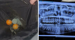 62 Times People Forgot Something And Ended Up In Funny Unfortunate Situations (New Pics)