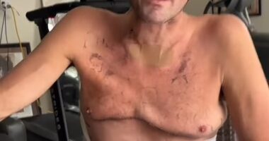Ben Askren has revealed he has a long road ahead as he targets a full recovery