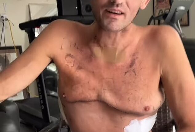 Ben Askren has revealed he has a long road ahead as he targets a full recovery