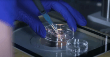 IVF