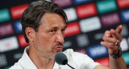 Borussia Dortmund boss Niko Kovac suggested Club World Cup pitches resemble a golf green