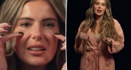 Brielle Biermann admits regrets over getting filler at young age