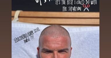 David Beckham has revealed he has attempted to fix his bald patch on his head after doing his own DIY buzz-cut on Sunday