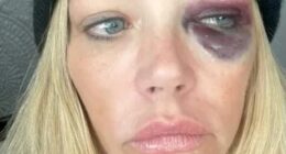 Denise Richards ’ split from husband Aaron Phypers is turning nastier by the day, with the Real Housewives of Beverly Hills alum now seeking court-ordered protection following a string of disturbing allegations; (photo from Richards' Request for Domestic Violence Retraining Order)