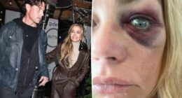 Denise Richards' estranged husband Aaron Phypers denies abuse allegations