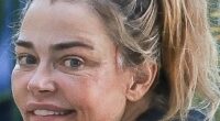Denise Richards ignited rampant plastic surgery speculation as she stepped out in LA this week - just days after making domestic violence claims against her estranged husband in a court paper