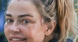Denise Richards ignited rampant plastic surgery speculation as she stepped out in LA this week - just days after making domestic violence claims against her estranged husband in a court paper