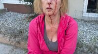Donna DeChristopher, 52, was left bloodied and bruised after a homeless man randomly attacked her in Los Feliz