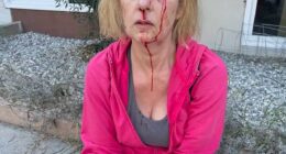 Donna DeChristopher, 52, was left bloodied and bruised after a homeless man randomly attacked her in Los Feliz