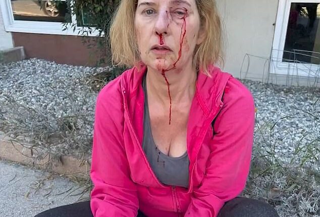 Donna DeChristopher, 52, was left bloodied and bruised after a homeless man randomly attacked her in Los Feliz