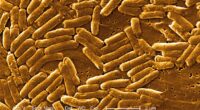 The above is a stock image of salmonella, a bacteria that has been linked to one of the outbreaks