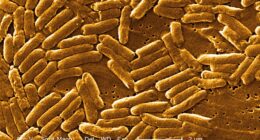 The above is a stock image of salmonella, a bacteria that has been linked to one of the outbreaks