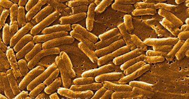 The above is a stock image of salmonella, a bacteria that has been linked to one of the outbreaks