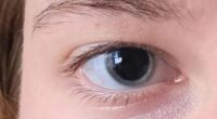 The young woman uploaded a picture to the 'Eyes' subreddit under the heading 'Why are my eyes so dilated?'