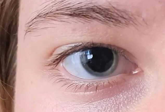 The young woman uploaded a picture to the 'Eyes' subreddit under the heading 'Why are my eyes so dilated?'