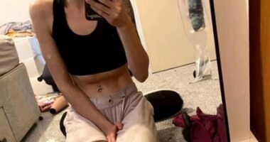 A devastating ketamine epidemic is exploding among young people. Pictured: Abby, who raises awareness for addiction recovery on TikTok, shares what she looked like while using the drug