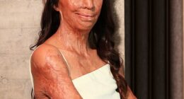 Burns survivor Turia Pitt (pictured) has revealed her new book