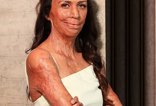 Burns survivor Turia Pitt (pictured) has revealed her new book