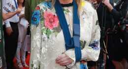 Liam Gallagher 's ex-wife Patsy Kensit revealed she's suffered a shocking accident , in a post shared just hours ahead of Oasis' huge reunion gig on Friday (pictured on Thursday evening)
