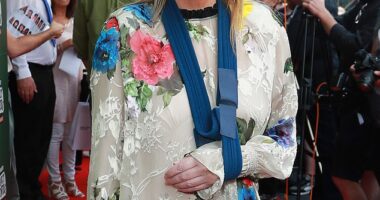 Liam Gallagher 's ex-wife Patsy Kensit revealed she's suffered a shocking accident , in a post shared just hours ahead of Oasis' huge reunion gig on Friday (pictured on Thursday evening)