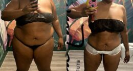 Lizzo took to Instagram on Thursday to display her extraordinary weight loss in stripped down side-by-side photos