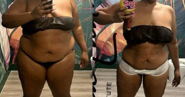 Lizzo took to Instagram on Thursday to display her extraordinary weight loss in stripped down side-by-side photos