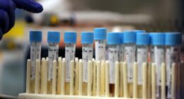 Medical Journals Flooded With AI Generated 'Research' – HotAir