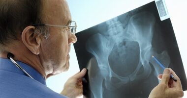 More than 100 leading NHS doctors have warned Health Secretary Wes Streeting that failing to honour his pre-Election commitment to urgently rollout screening clinics for osteoporosis risks causing thousands of preventable deaths (stock image)