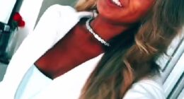 Teenager Megan Blain, 18, has admitted to being addicted to sunbeds, despite facing harsh criticism online and noticing concerning changes to her skin