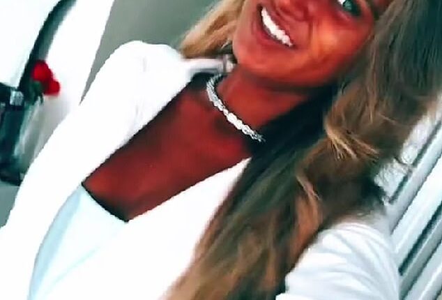 Teenager Megan Blain, 18, has admitted to being addicted to sunbeds, despite facing harsh criticism online and noticing concerning changes to her skin