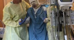 An American woman has revealed her miraculous recovery from a horror gas station explosion almost six years ago after the accident led to 40 per cent of her body being covered in third-degree burns