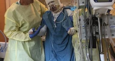 An American woman has revealed her miraculous recovery from a horror gas station explosion almost six years ago after the accident led to 40 per cent of her body being covered in third-degree burns