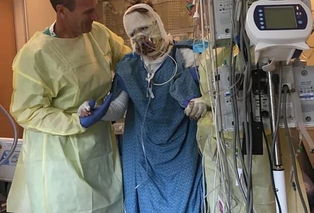 An American woman has revealed her miraculous recovery from a horror gas station explosion almost six years ago after the accident led to 40 per cent of her body being covered in third-degree burns