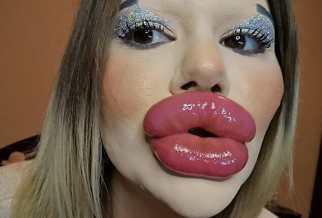 Andrea Ivanova from Bulgaria has become known for having the world's biggest lips after splashing out on £20,000 of filler (pictured)